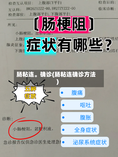 肠粘连。确诊(肠粘连确诊方法)-第3张图片