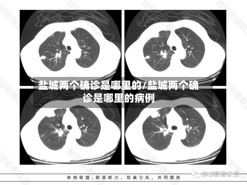 盐城两个确诊是哪里的/盐城两个确诊是哪里的病例