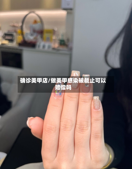 确诊美甲店/做美甲感染被截止可以赔偿吗