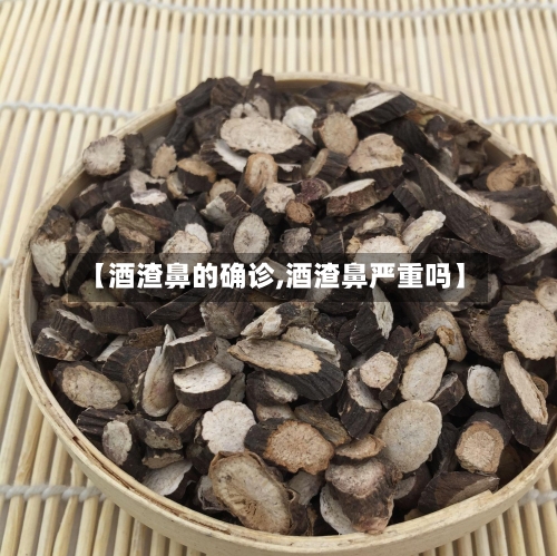 【酒渣鼻的确诊,酒渣鼻严重吗】