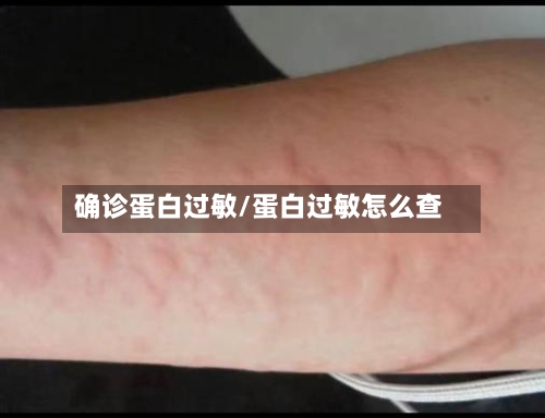 确诊蛋白过敏/蛋白过敏怎么查-第2张图片