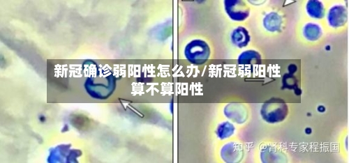 新冠确诊弱阳性怎么办/新冠弱阳性算不算阳性-第2张图片