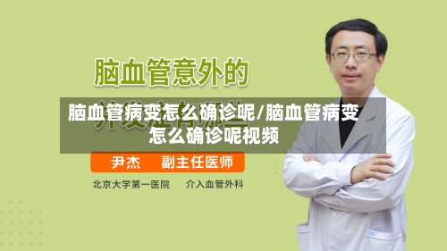 脑血管病变怎么确诊呢/脑血管病变怎么确诊呢视频-第3张图片