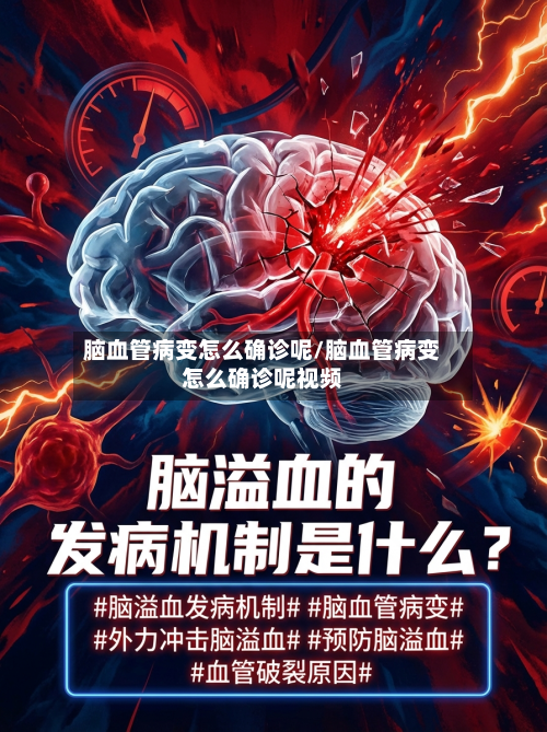 脑血管病变怎么确诊呢/脑血管病变怎么确诊呢视频