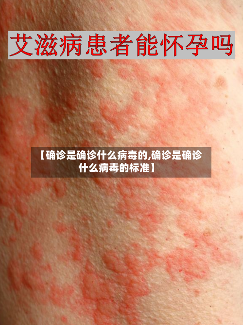 【确诊是确诊什么病毒的,确诊是确诊什么病毒的标准】