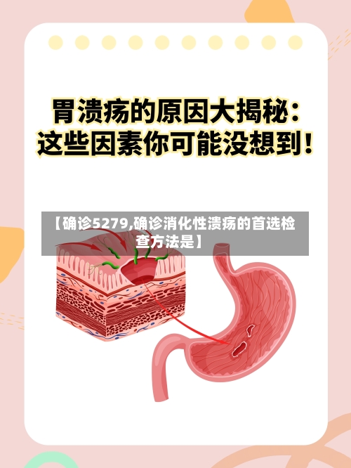 【确诊5279,确诊消化性溃疡的首选检查方法是】