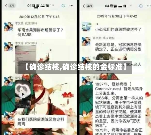 【确诊结核,确诊结核的金标准】-第2张图片