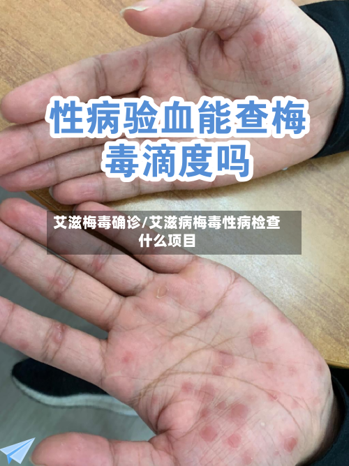 艾滋梅毒确诊/艾滋病梅毒性病检查什么项目-第2张图片