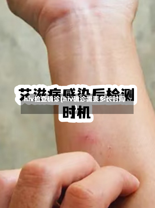 hiv检查确诊(hiv确诊需要多长时间)-第2张图片