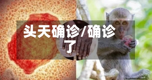 头天确诊/确诊了-第2张图片